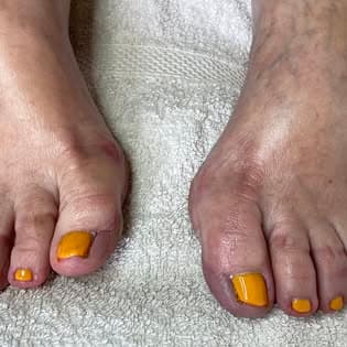 Soins des pieds