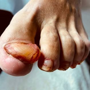 Soin des pieds